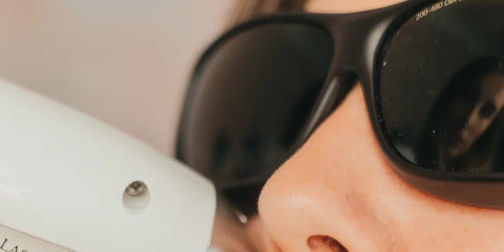 Laserová epilace i komplet balíčky: obličej, podpaží, nohy, třísla i celé tělo