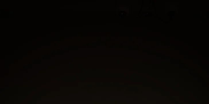 Hladká kůže bez práce: laserová epilace – podpaží, nohy i celé tělo