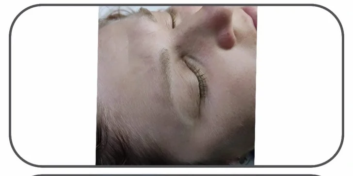 Ošetření problematické pleti i komplexní kosmetická péče značkou Alcina