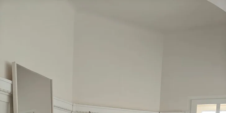 Profesionální péče o pleť a tělo: přístrojová anticelulitidní masáž nebo IPL omlazení