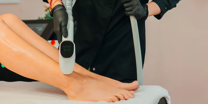 Laserová epilace partie dle výběru: podpaží, obličej, bikiny, nohy i celé tělo