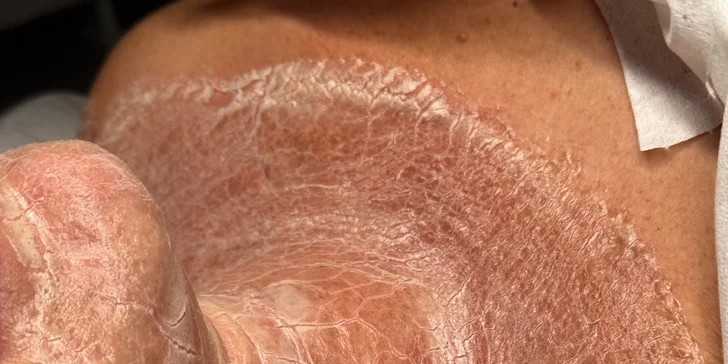 Komplexní péče o pleť: regenerační, hydratační i liftingové ošetření či enzymová terapie