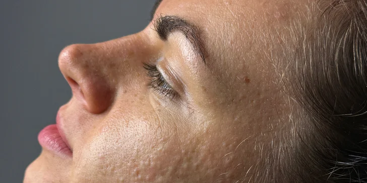 Komplexní péče o pleť: regenerační, hydratační i liftingové ošetření či enzymová terapie