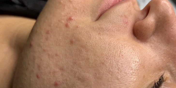 Komplexní péče o pleť: regenerační, hydratační i liftingové ošetření či enzymová terapie