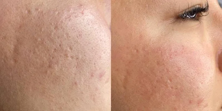 Komplexní péče o pleť: regenerační, hydratační i liftingové ošetření či enzymová terapie