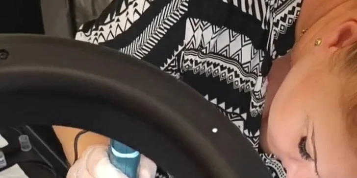 Mezoterapie neboli mikrojehličkování pro omlazení a obnovu pleti