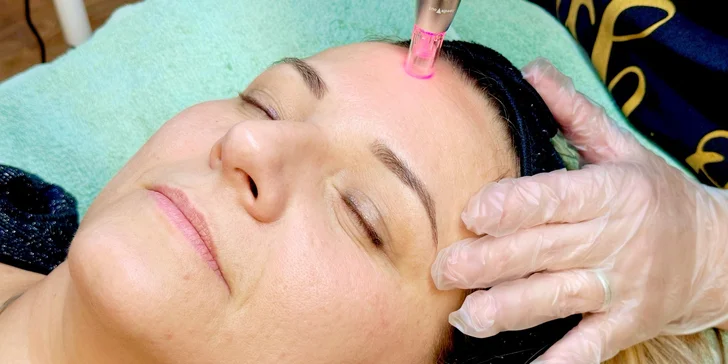 Mezoterapie neboli mikrojehličkování pro omlazení a obnovu pleti