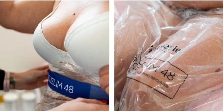 Rychlé formování postavy: EMS posilování, spalování tuků nebo Vacuslim zábal