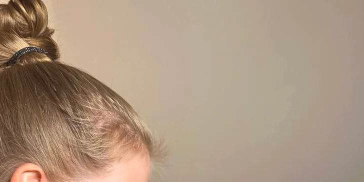 Komplexní péče o pleť: regenerační, hydratační i liftingové ošetření či enzymová terapie