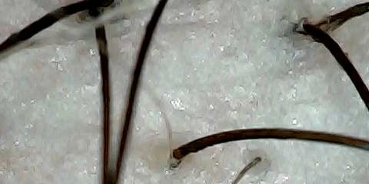 Detoxikace pokožky hlavy i vlasů včetně střihu a foukané ve Studiu Bona Dea