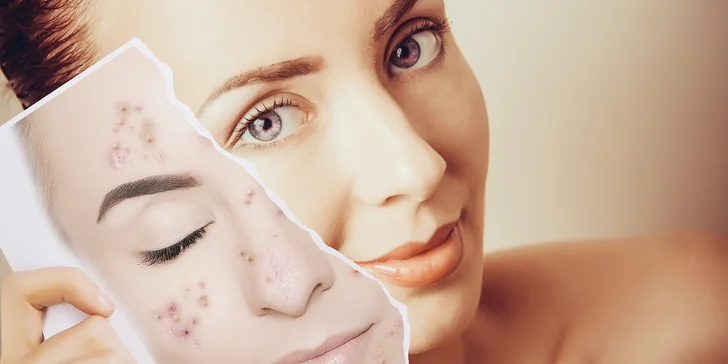 Kosmetické ošetření: pro mladou problematickou pleť nebo základní s masáží