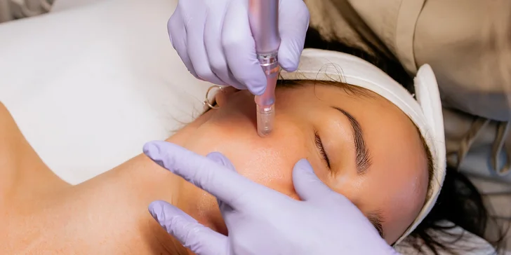 Antipigmentační ošetření, mikrojehličkování, čištění i neinvazivní facelift, 60–90 minut