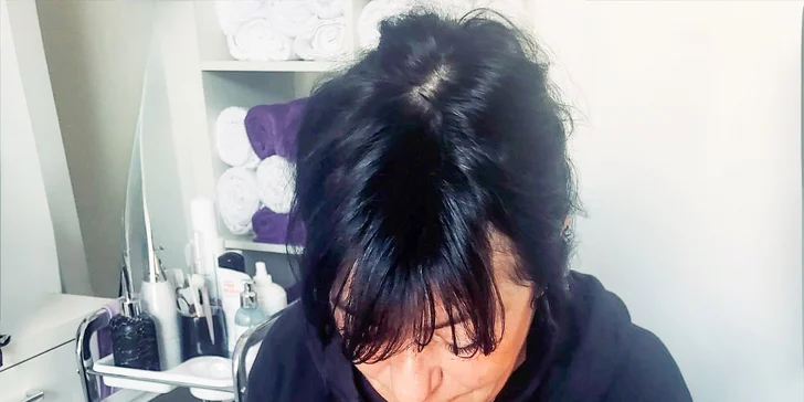 Kosmetické ošetření v salonu na Vinohradech: lifting, kolagen i PDRN DNA terapie