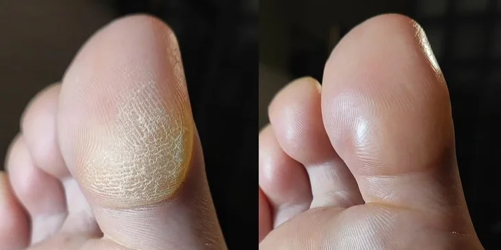 Pedikúra dle výběru: lázeň, P-Shine, peeling, masáž i aplikace laku