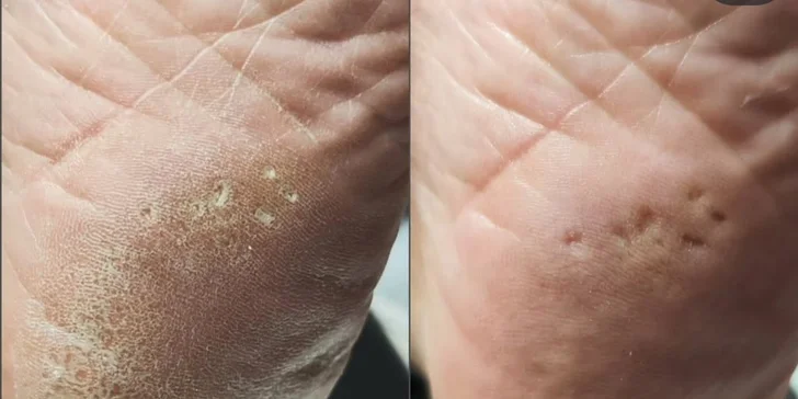 Pedikúra dle výběru: lázeň, P-Shine, peeling, masáž i aplikace laku