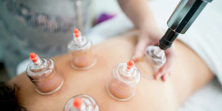 Baňková masáž zad nebo nohou: 30 min. i permanentka až 15 procedur