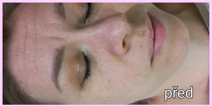 Vyberte si svou dávku krásy: Lifting řas, laminace, peeling i zábal na ruce
