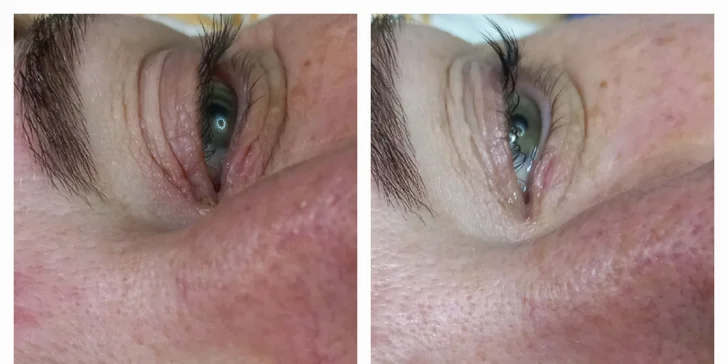 Vyberte si svou dávku krásy: Lifting řas, laminace, peeling i zábal na ruce