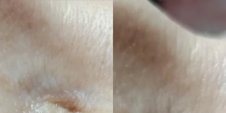 Rozmazlete sebe i svou pleť: hydratační či anti-age ošetření, lifting řas nebo laminace obočí