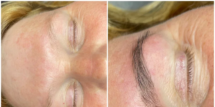 Kosmetické ošetření v salonu na Vinohradech: pro aknózní pleť i Deluxe péče s úpravou obočí