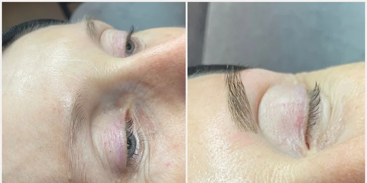 Kosmetické ošetření v salonu na Vinohradech: pro aknózní pleť i Deluxe péče s úpravou obočí