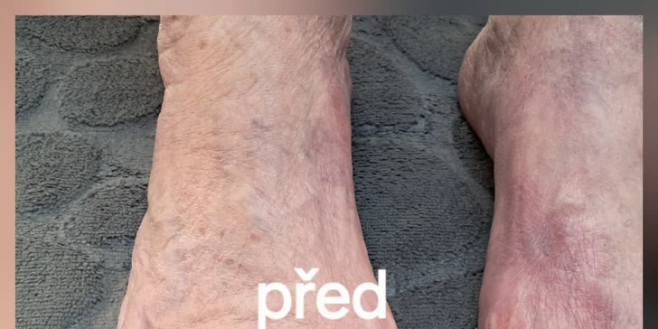 Kompletní mokrá pedikúra s lakováním nebo odolným Shellacem