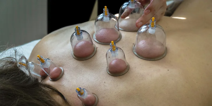 Masáž zad a šíje vč. baňkování: úleva a regenerace během 40 minut