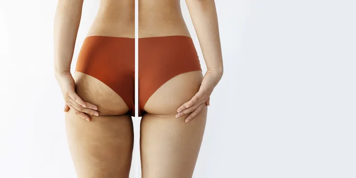 Přístrojová lymfodrenážní masáž včetně uvolnění lymfatických uzlin