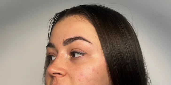 Krásná pleť: chemický peeling s AHA kyselinami v centru Brna