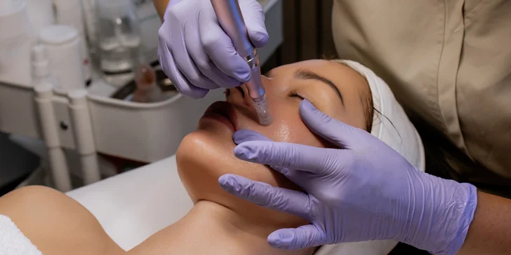 Mikrojehličkování s lososím DNA: revoluční péče pro obnovu pleti