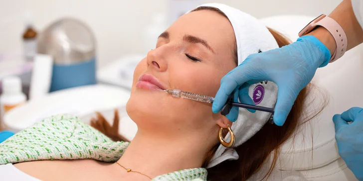 Výplň a hydratácia pier, tvarovanie líčok alebo vyplnenie hlbokých vrások kyselinou hyalurónovou