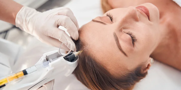 VITAL MEZO – HAIR: vlasová mezoterapia na mieru pre vaše vlasy