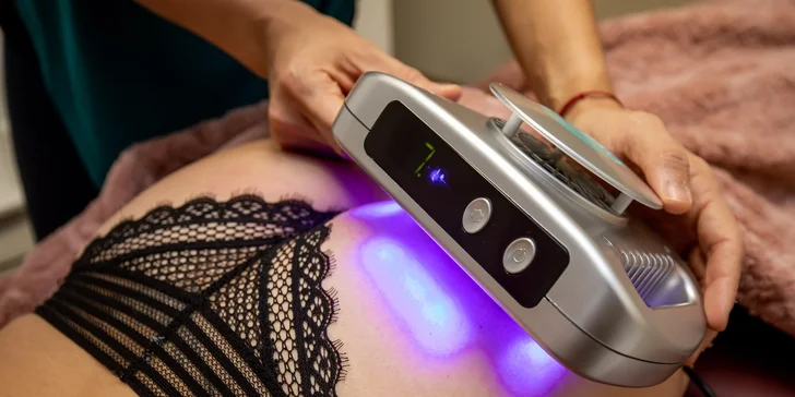 Kryolipolýza pre boj s kilami v štúdiu Bubema