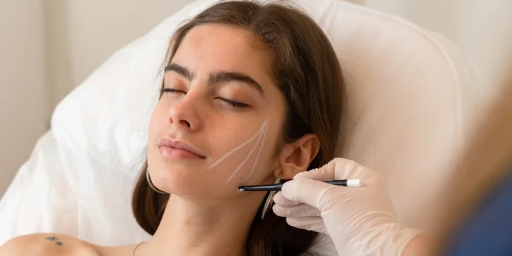 Profesionálne zúženie tváre vo Vultus Clinic