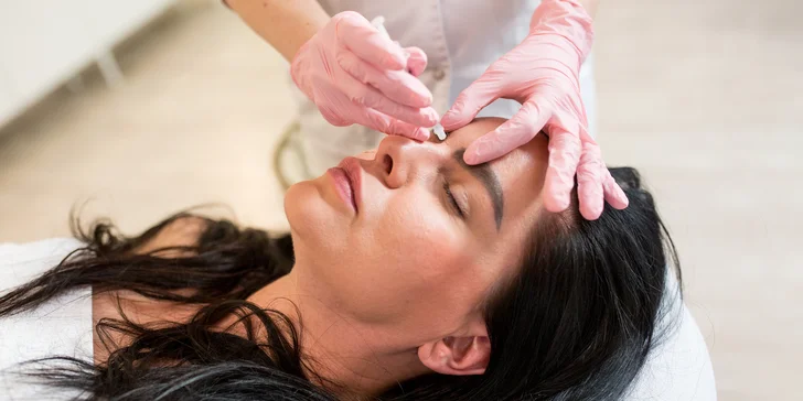 Aplikácia botulotoxínu: Odstránenie vrások, ovisnutých kútikov či bruxizmu