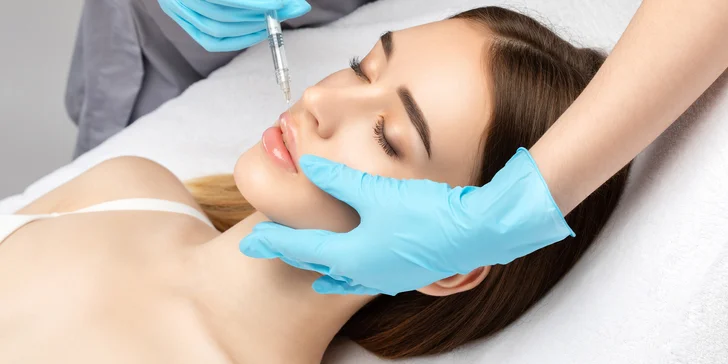 Šťavnaté hydratované pery po celý rok - výplň pier kyselinou hyalurónovou