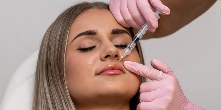 Výplň alebo hydratácia pier kyselinou hyalurónovou v Neuroderm