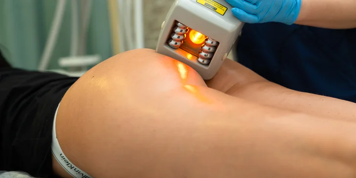 Kamu Shape: Novinka na odstránenie celulitídy a spevnenie pokožky