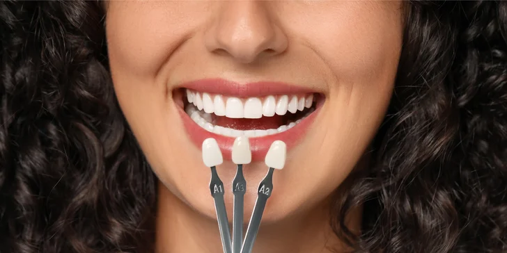 Linea Dent Poprad: Dentálna hygiena – samostatne aj v kombinácii s bielením zubov