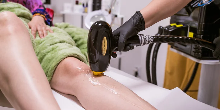 Odstránenie ochlpenia pomocou vysoko výkonného diódového lasera