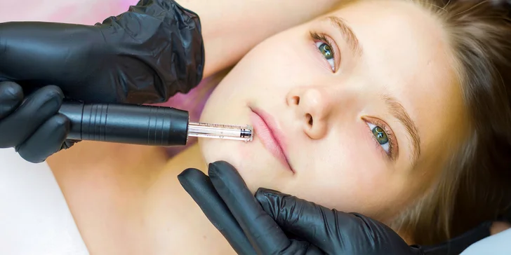 Zväčšenie pier či vyhladenie vrások pomocou Hyaluron Pen