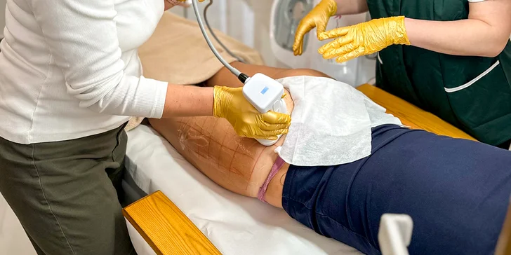 Neinvazívna liposukcia ultrazvukom Liposonix AVA .I.