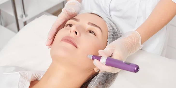 Mezoterapia tváre so sérom podľa vašej voľby alebo lososou DNA pre revitalizáciu pokožky