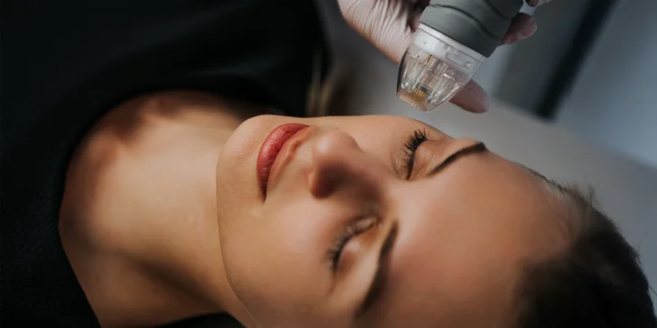 Neinvazívny facelifting pomocou mikroihličkovej frakčnej (MF) rádiofrekvencie: okolie očí, čelo alebo celá tvár