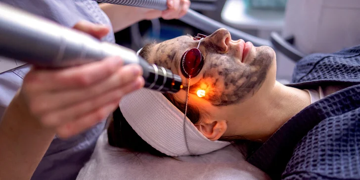 Komplexné ošetrenie HOLLYWOOD CARBON PEEL, aj permanentka na 4 ošetrenia