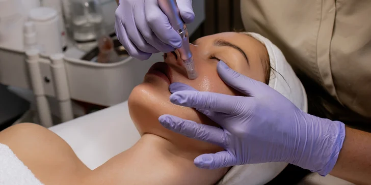 Mezoterapia tváre či pokožky hlavy alebo microneedling na odstránenie jaziev
