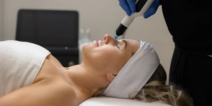 Účinná laserová liečba akné studenou plazmou