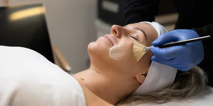 Omladnite bez skalpela pomocou chemického peelingu, v ponuke aj permanentky