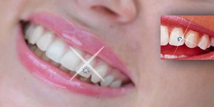 299 Kč za nalepení originálního kamínku Swarovski na zuby. Záře a třpyt v každém vašem úsměvu se slevou 40%.
