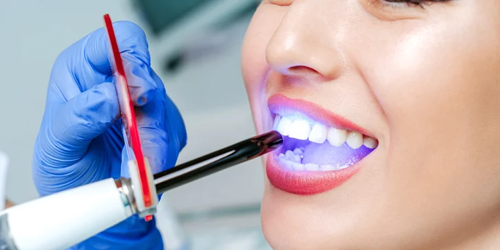 Dental Sisters vám pomôžu získať želaný odtieň chrupu